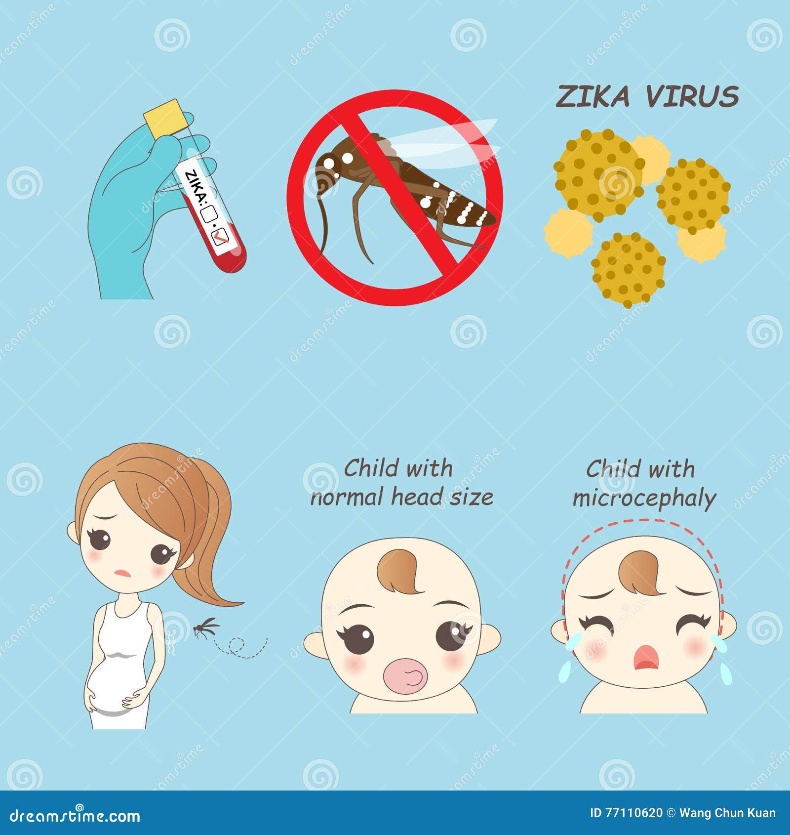 Zika Virus And Pregnant Women Stock Vector Illustration Of Medical 