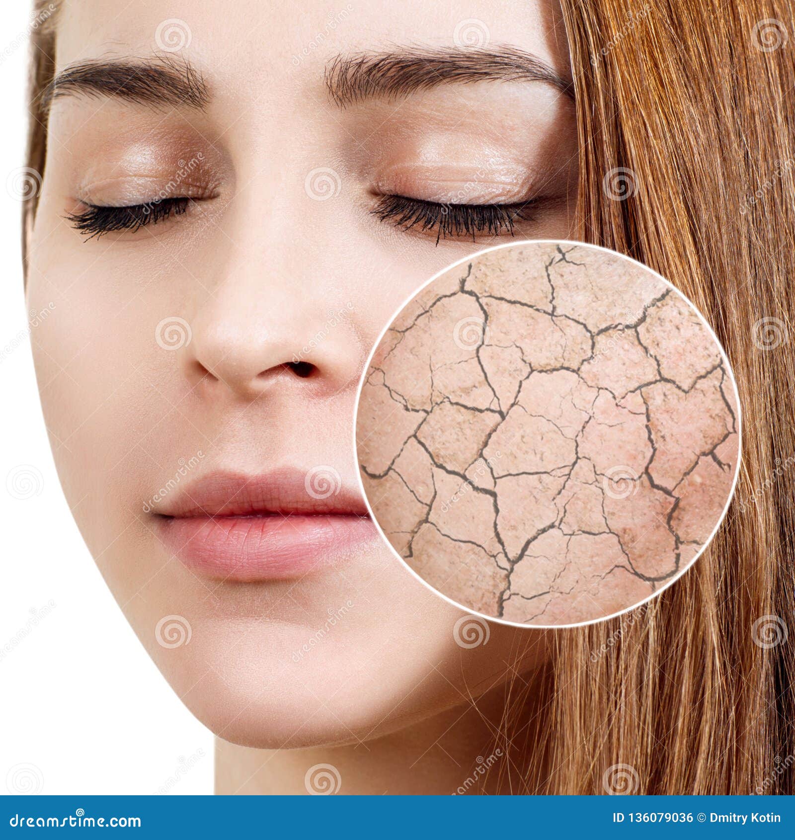 Zoom Circle Shows Dry Facial Skin Before Moistening Stock Photo