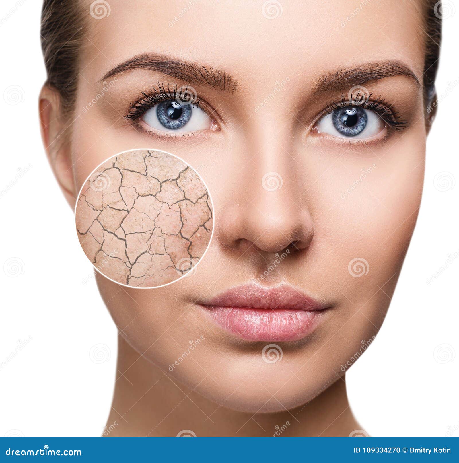 Zoom Circle Shows Facial Skin Before Moistening Stock Photo Image Of