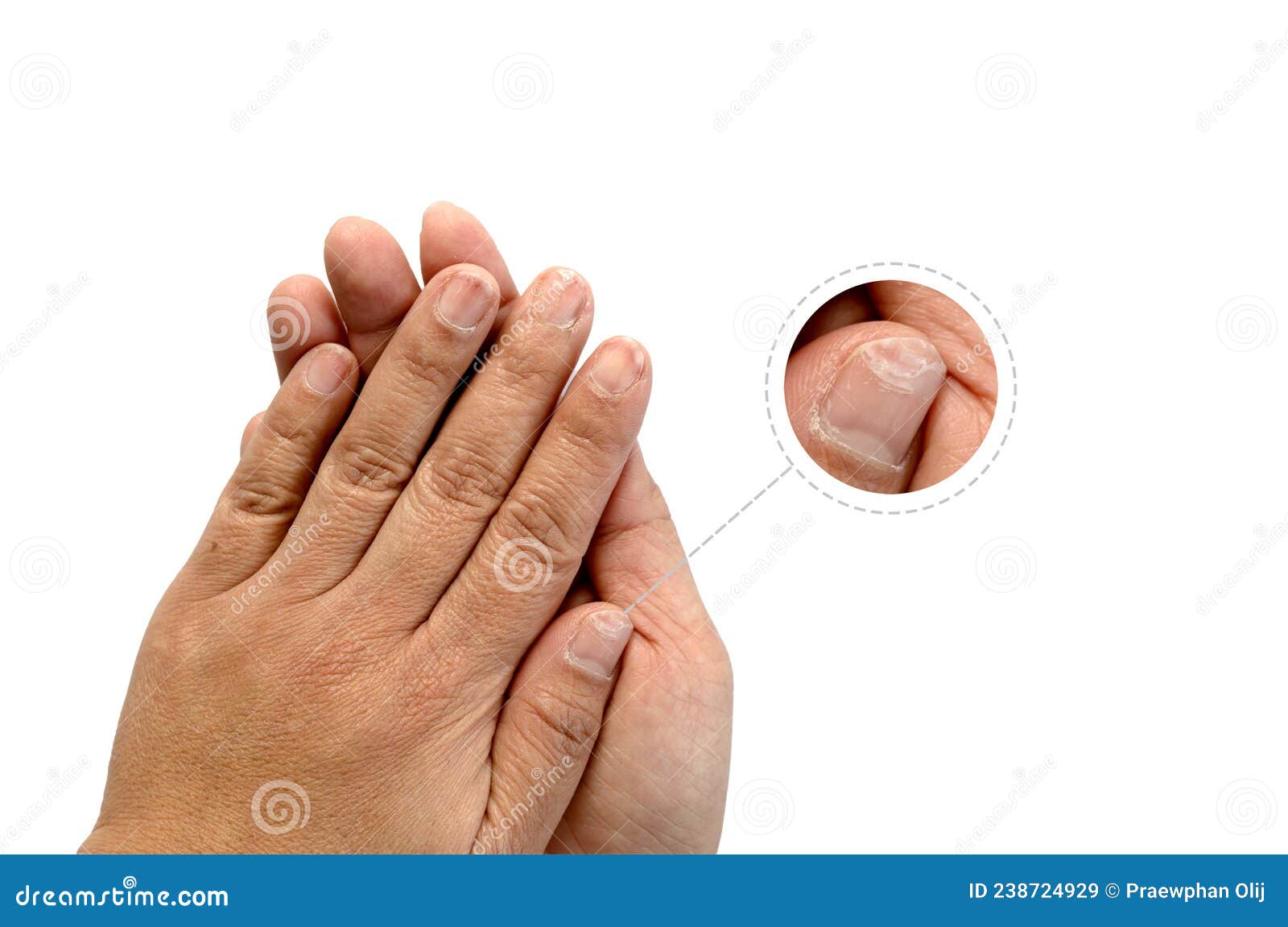 X ray Image Of IVP Prone Position Stock Photography CartoonDealer x-ray-image-of-ivp-prone-position-stock-photography-cartoondealer