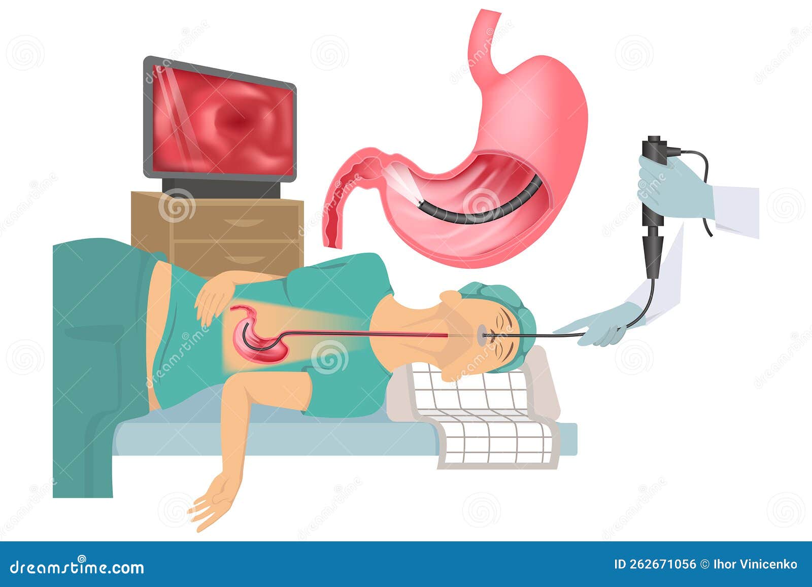 Gastroscopy Of The Stomach. Esophagoscopy,diagnostic Procedure.A Man Is