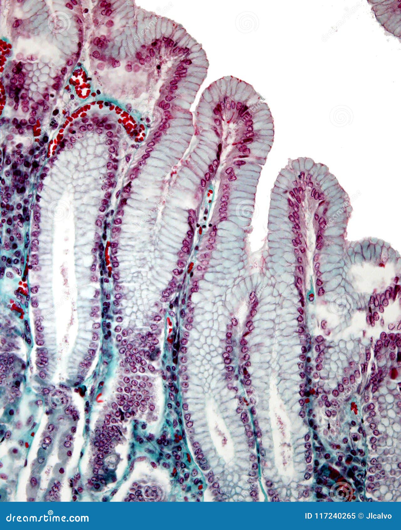 Żołądkowe jamy Masson trichrome plama. Żołądkowy mucosa plamiący z Masson trichrome plamą Nawierzchniowy nabłonek żołądek invaginates tworzyć żołądkowe jamy Ja jest prostym kolumnowym nabłonkiem tworzącym śluzowymi komórkami