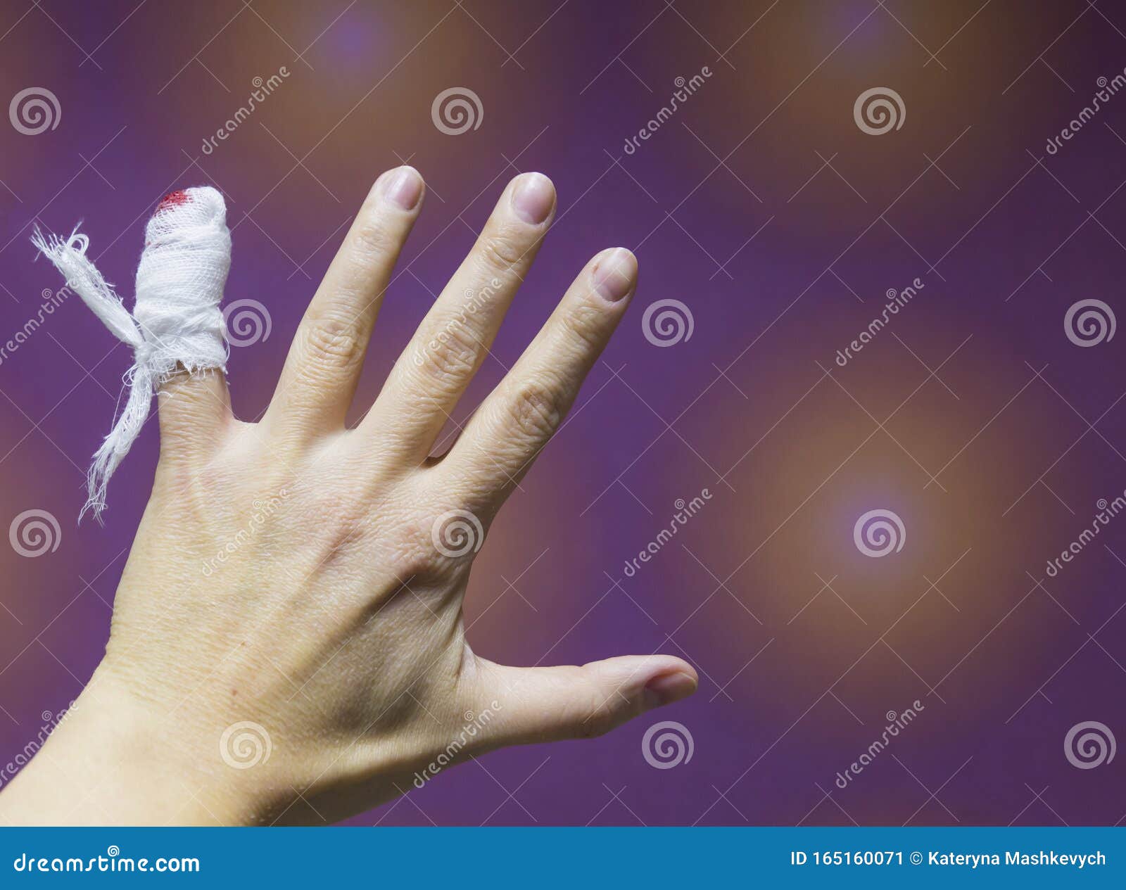 Bandaged hand featuring accident, aid, and arm | Health & Medical Stock Photos ~ Creative Market