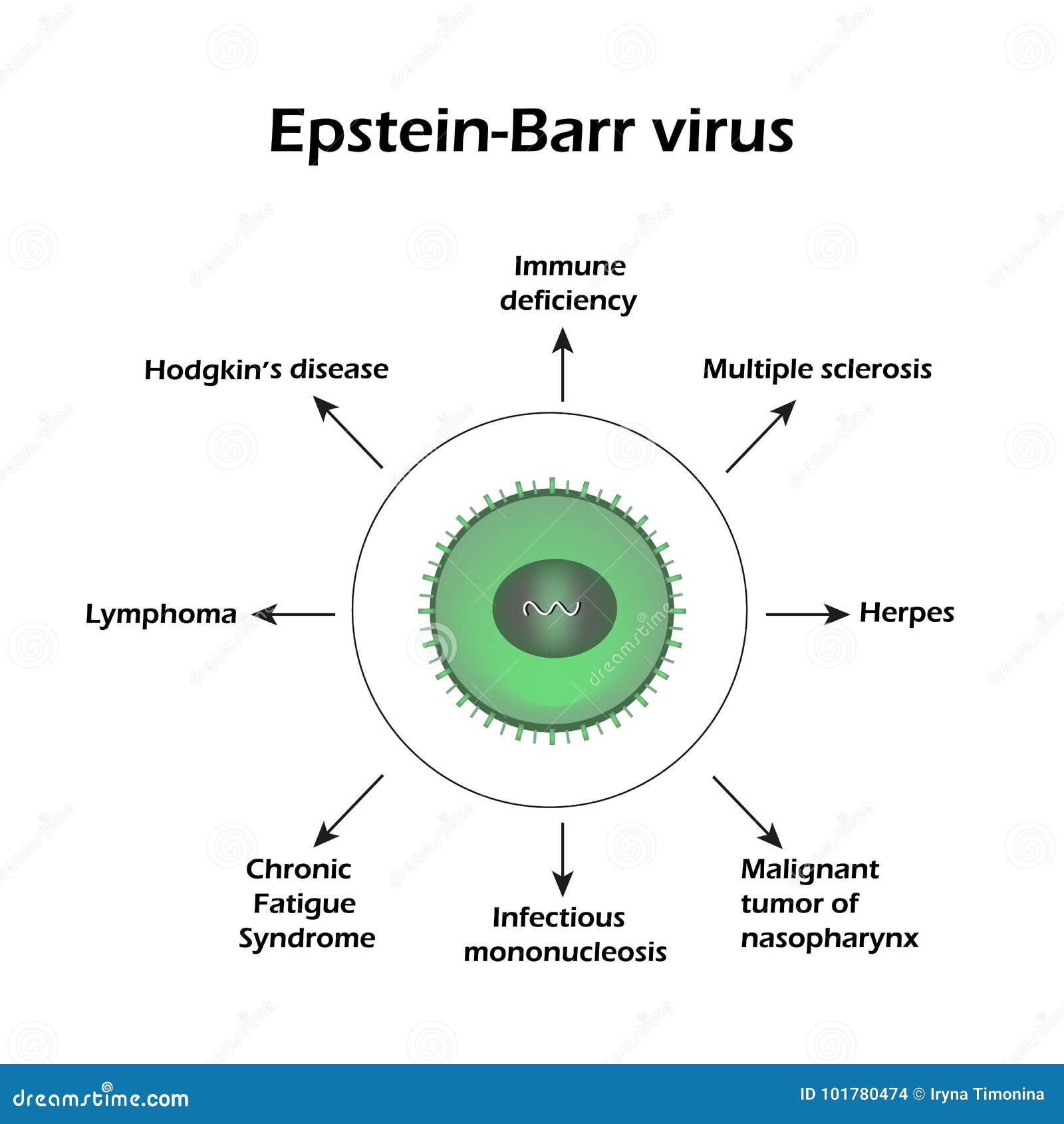 vírus epstein barr)