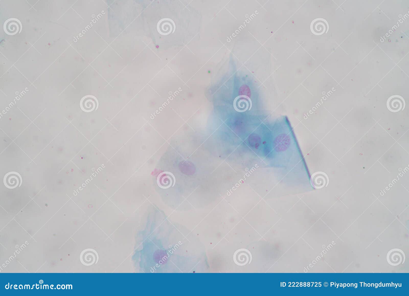 гистологический образец плоскоклеточных эпителиальных клеток под ...