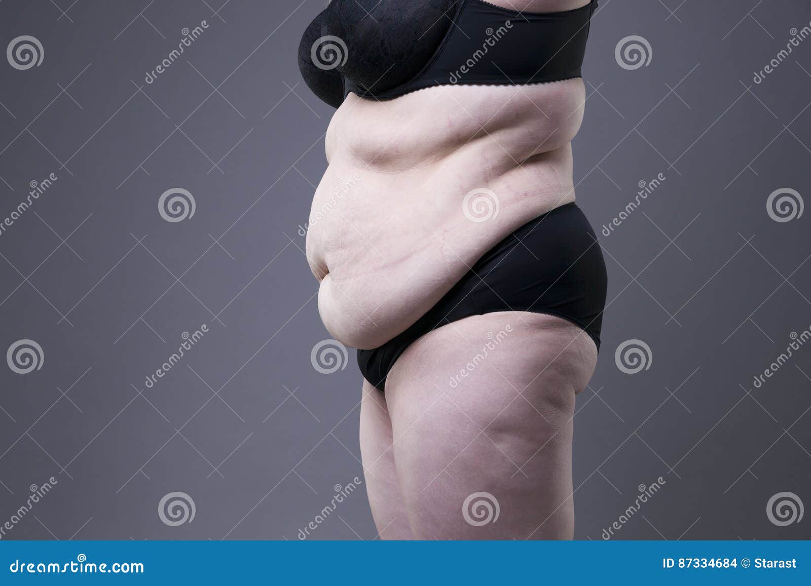 Жирное женское тело