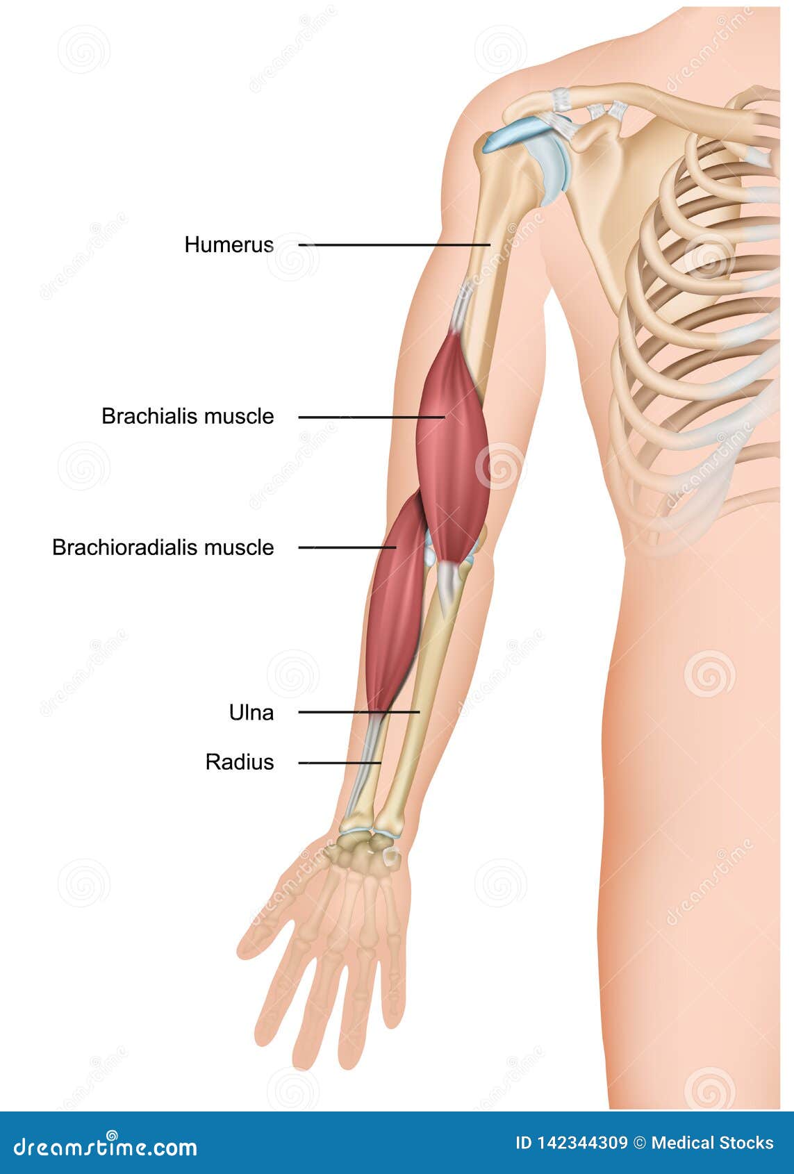 Brachialis arthrosis jelei