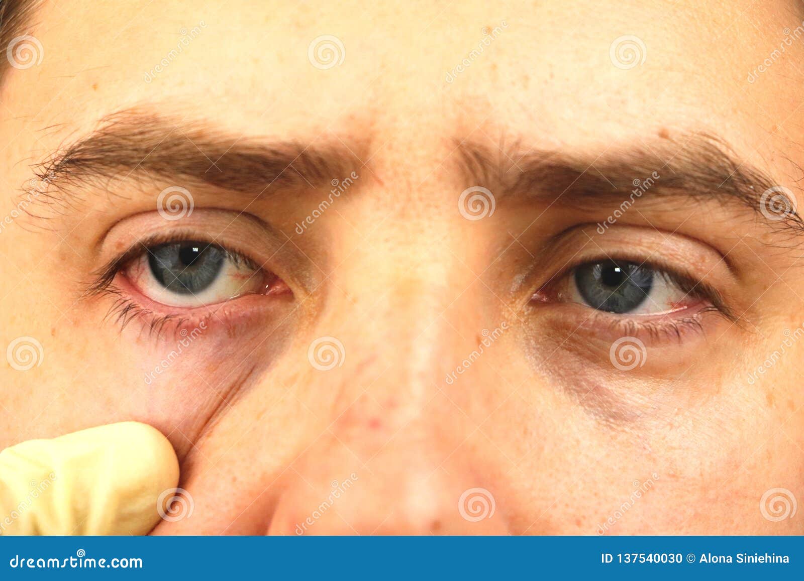 Как убрать красные глаза в Snapseed