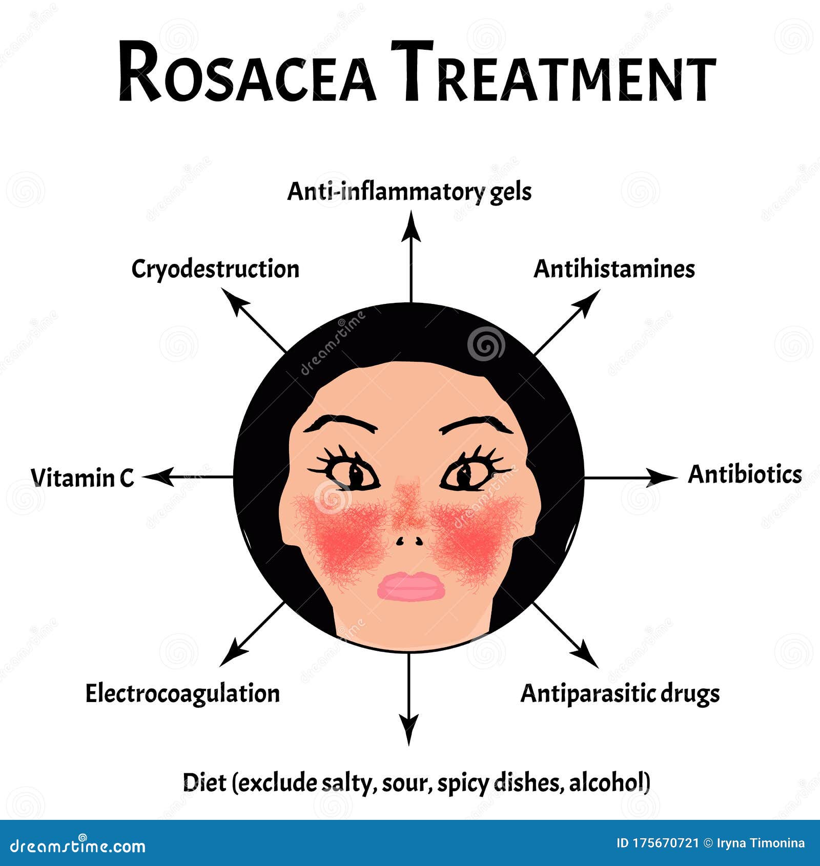 Обработка розацеа. Месяц сознания розацеа. Infographics. Иллюстрация ...