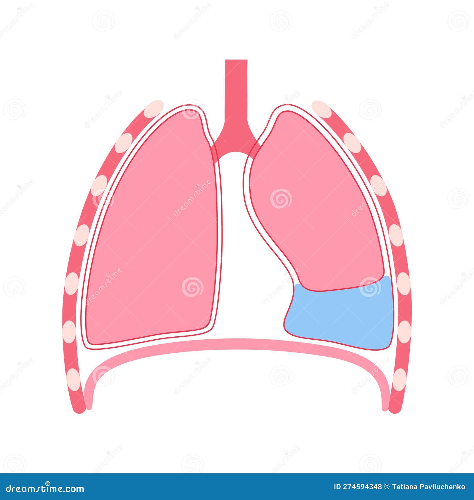 плакат о плевральном эффекте Иллюстрация вектора - иллюстрации ...