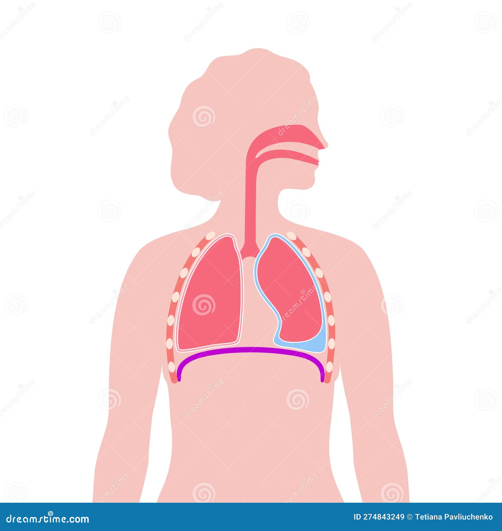 плакат о плевральном эффекте Иллюстрация вектора - иллюстрации ...