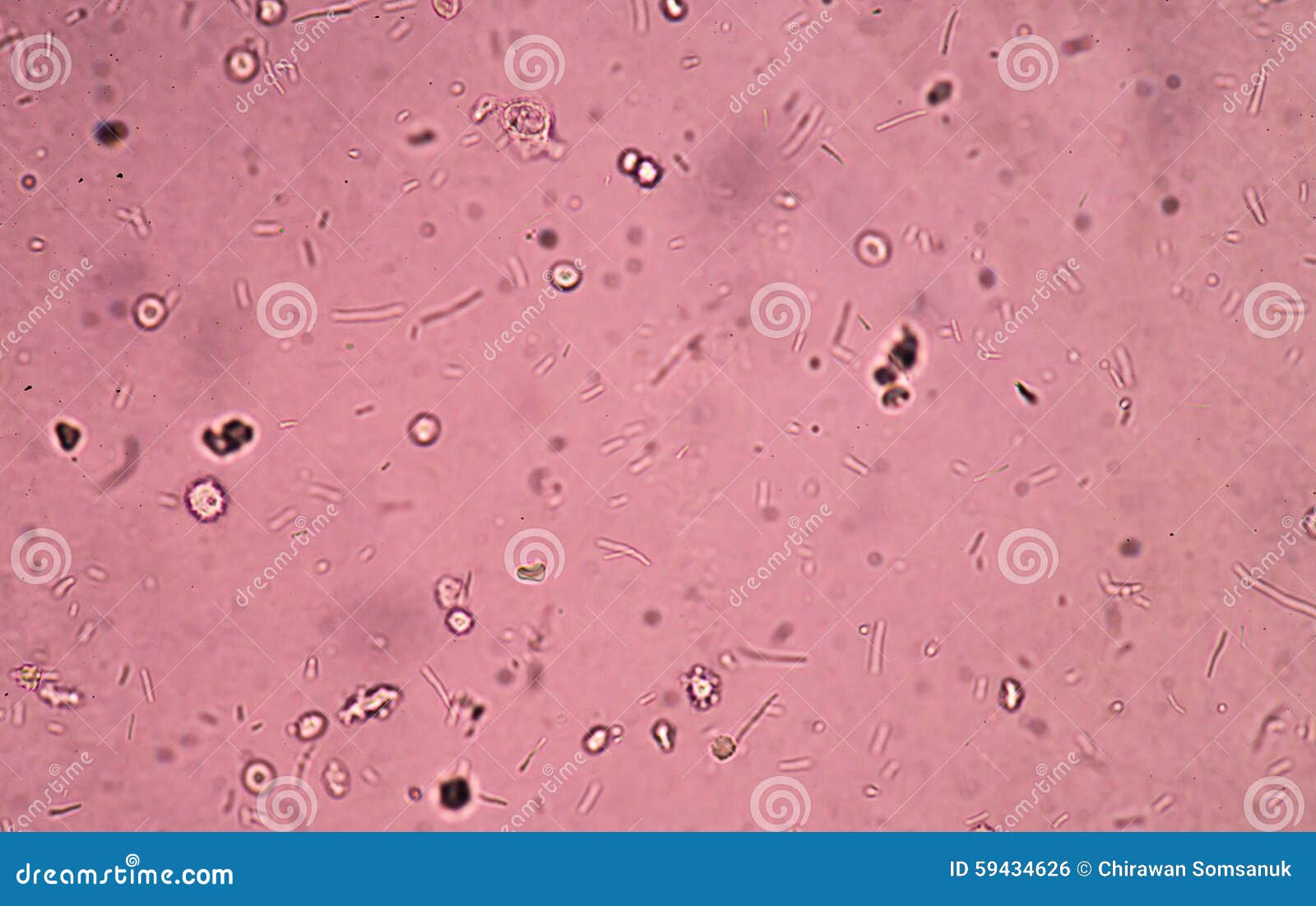 Свежие бактерии в моче стоковое фото. изображение насчитывающей ...