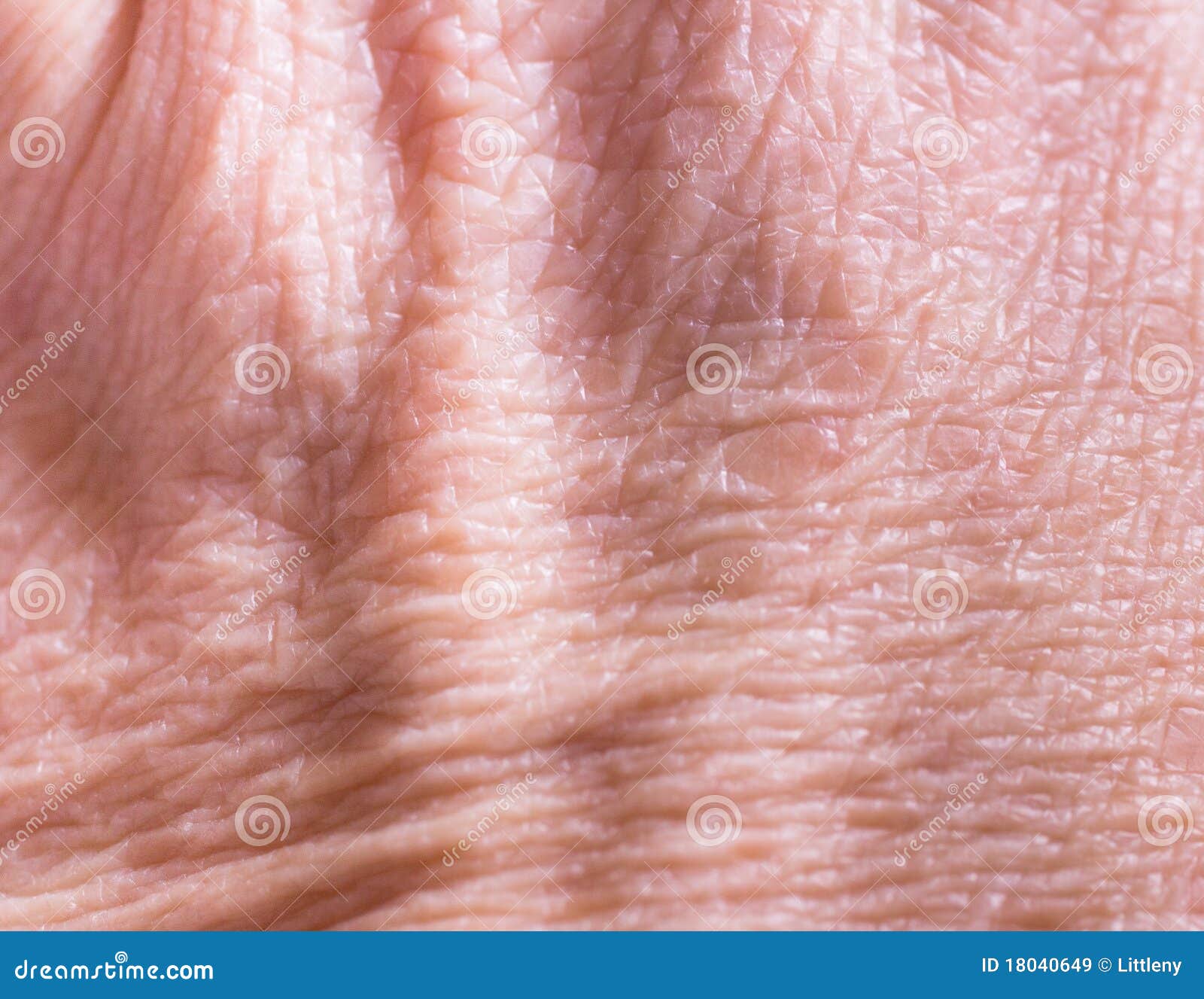 Сухая морщинистая кожа рук