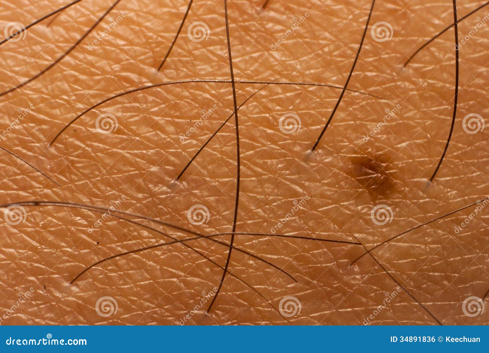 Текстура кожи и волос тела. Закрытый-вверх на коже показывая свои текстуру и волосы и веснушки тела