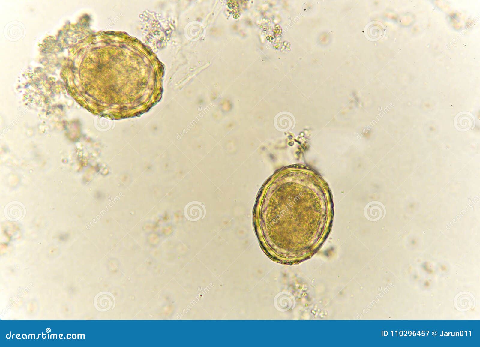 Ascaris lumbricoides яйца микроскоп