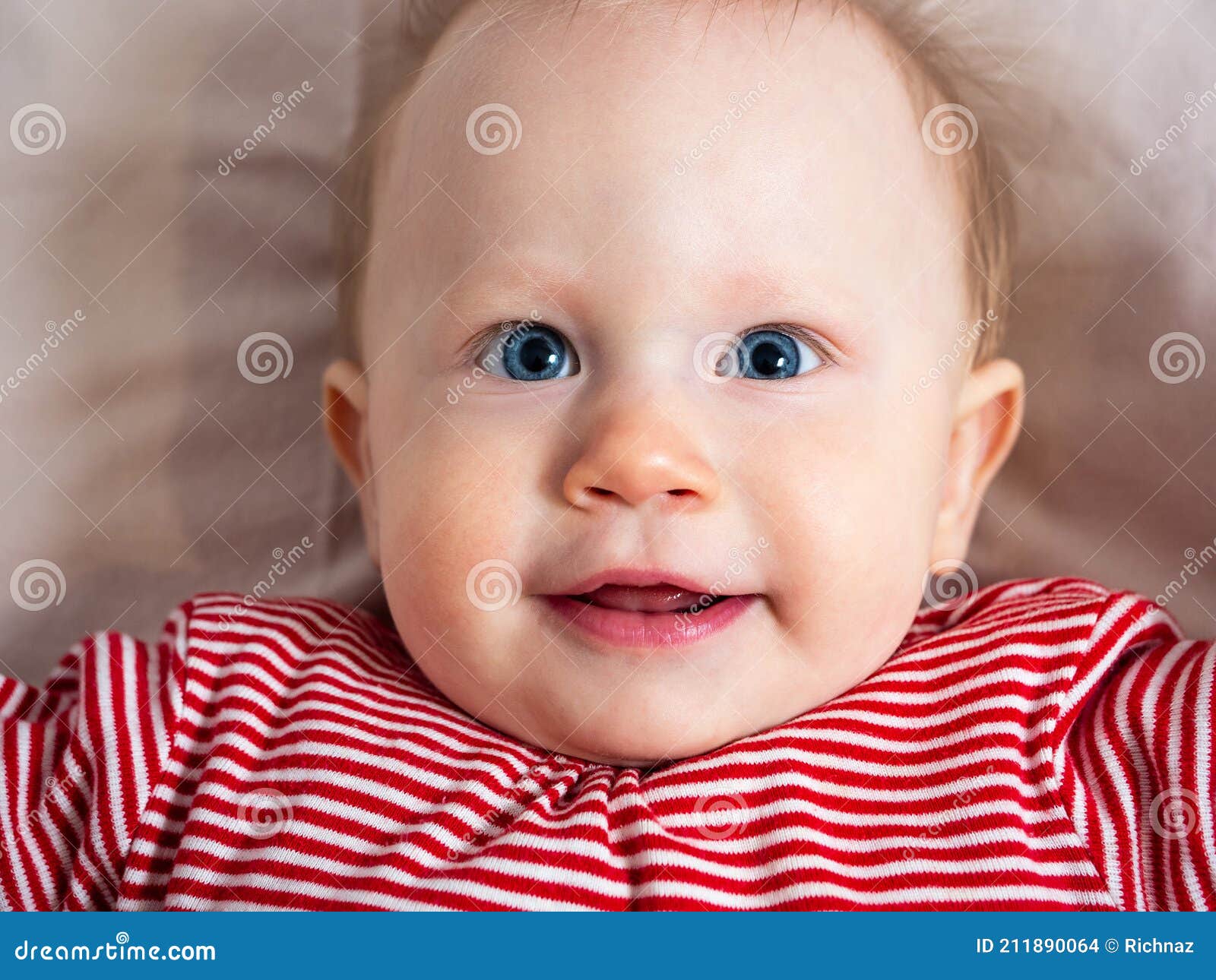 宝宝16个月，今天突然发现孩子上面两片小阴唇分别粘在两侧大阴唇，现在该怎么办？要做分离么|儿科|丁香医生