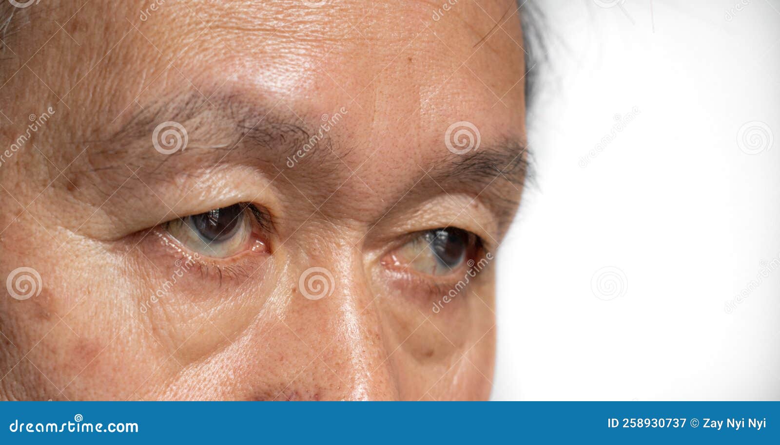 亚洲老人眼皮皱皱 库存图片. 图片 包括有 龙舌兰, 发红光的, 摩尔, 韩文, 涅维, 眼睛, 公平 - 231935291