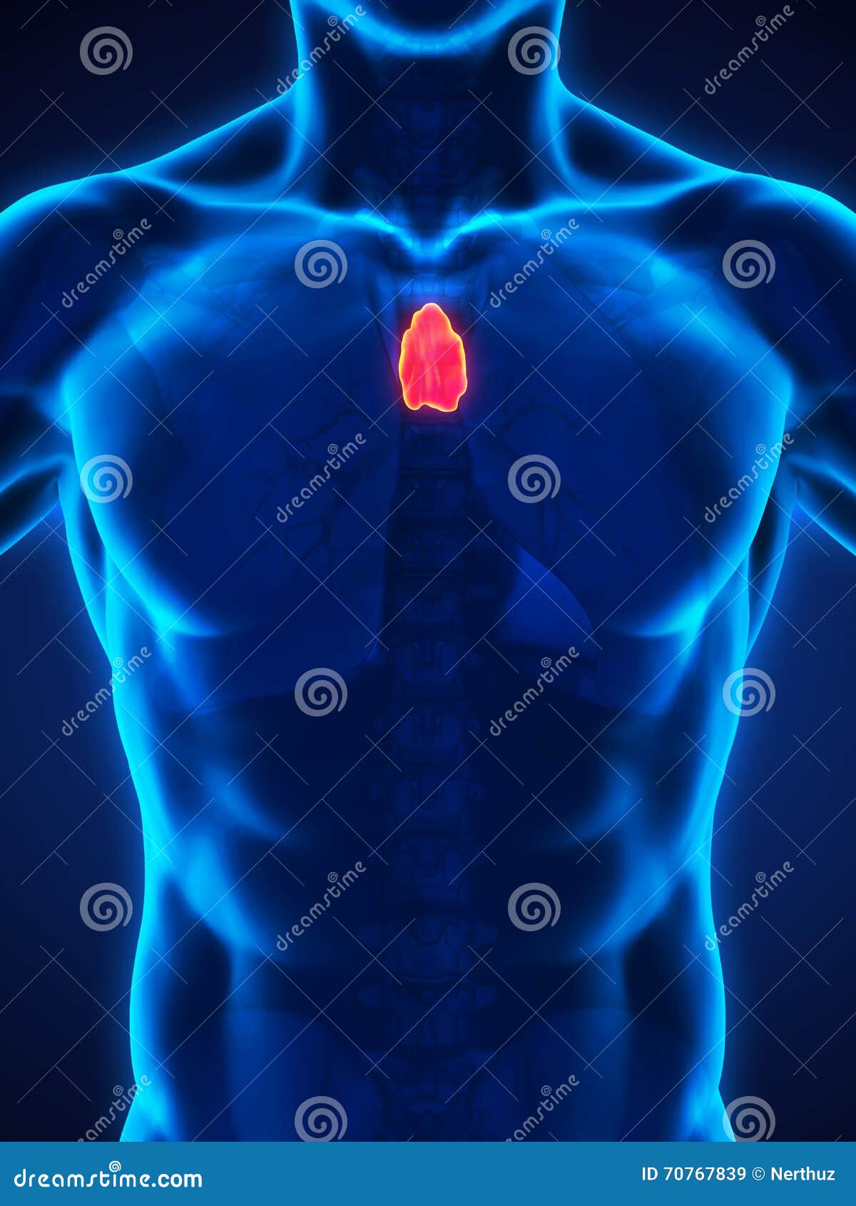 内分泌-70-31. 胸腺瘤