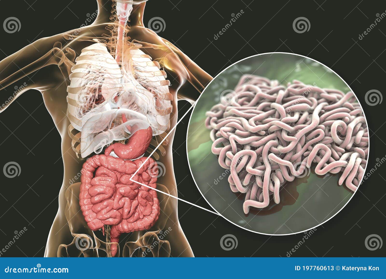 猪肠鞭虫病-吉林大学动物医学学院标本信息管理平台
