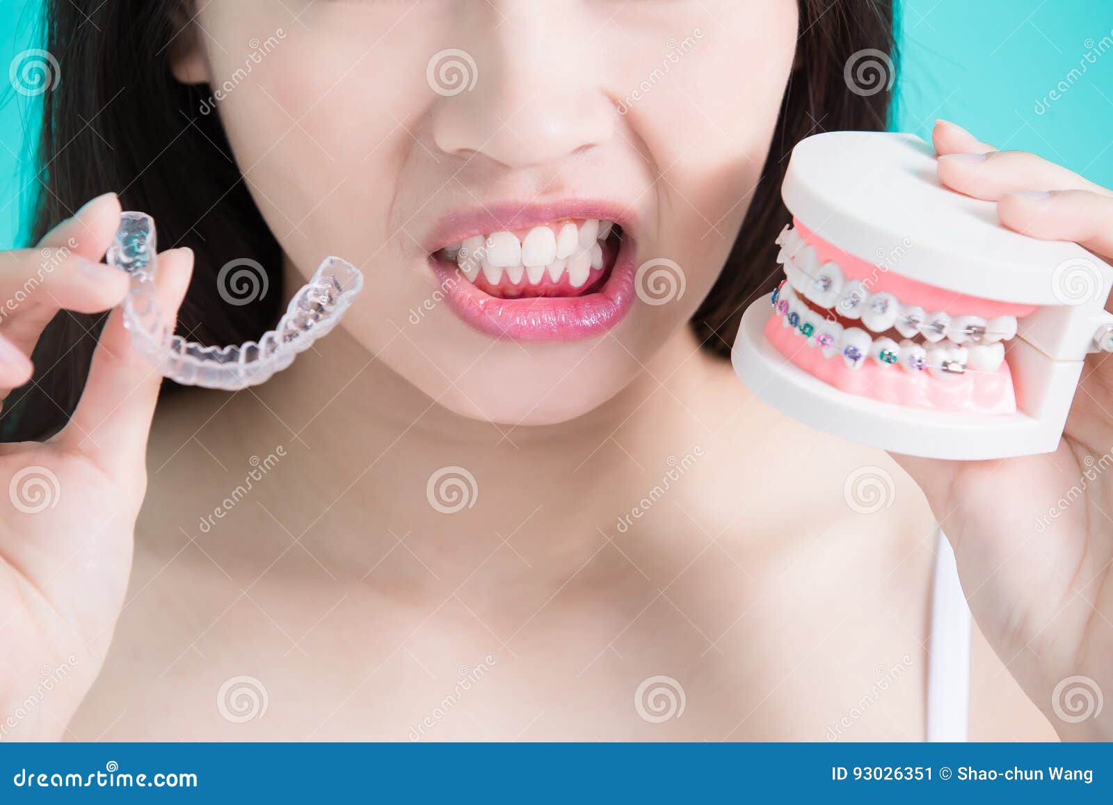 牙齒排列整齊卻暴牙？改善側面輪廓案例-林小姐 - 展心展研林口牙醫診所