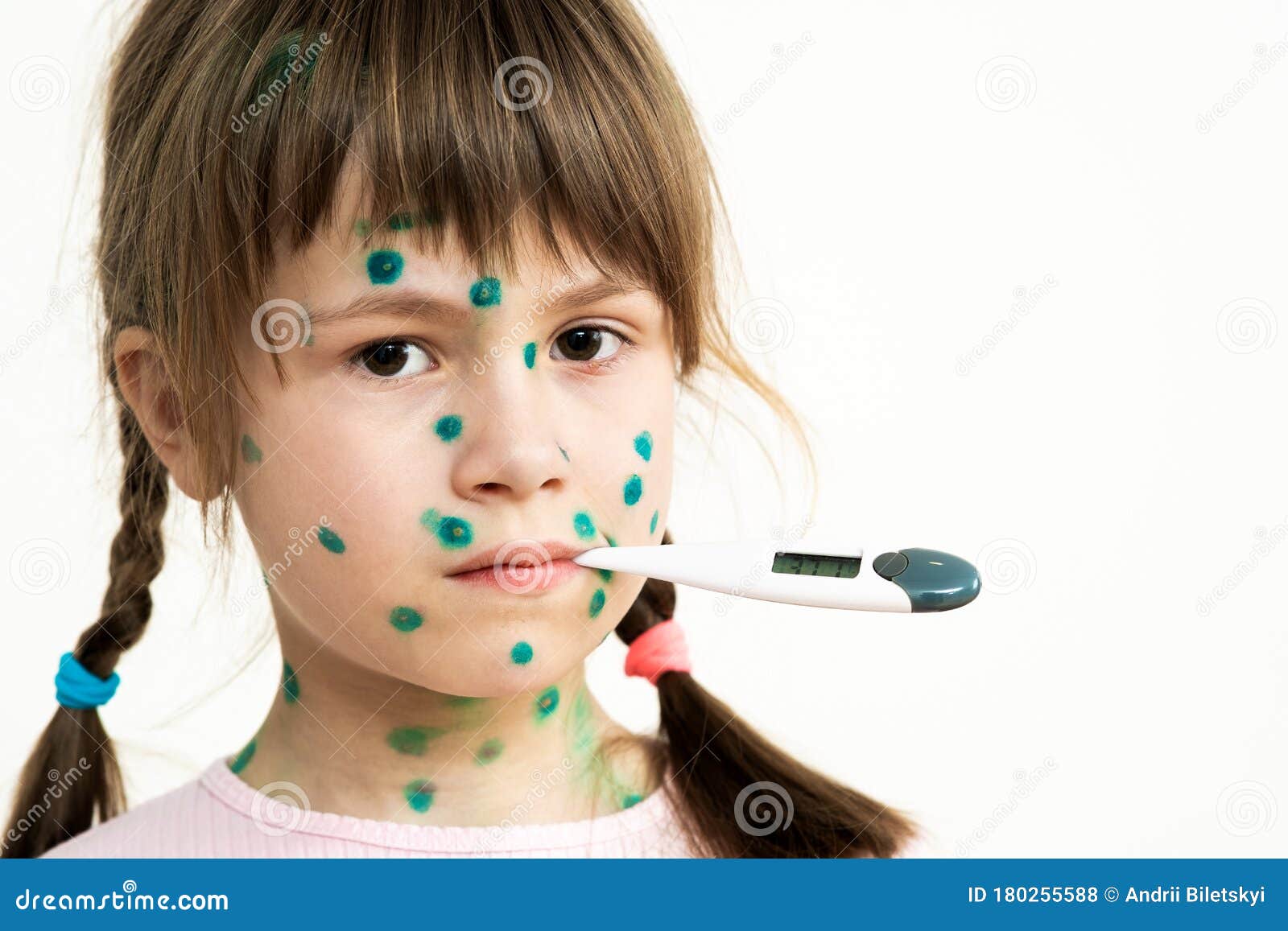 水痘图片是什么样的（春天孩子容易被传染水痘，这里有一份水痘的知识要点，家长必知） | 说明书网