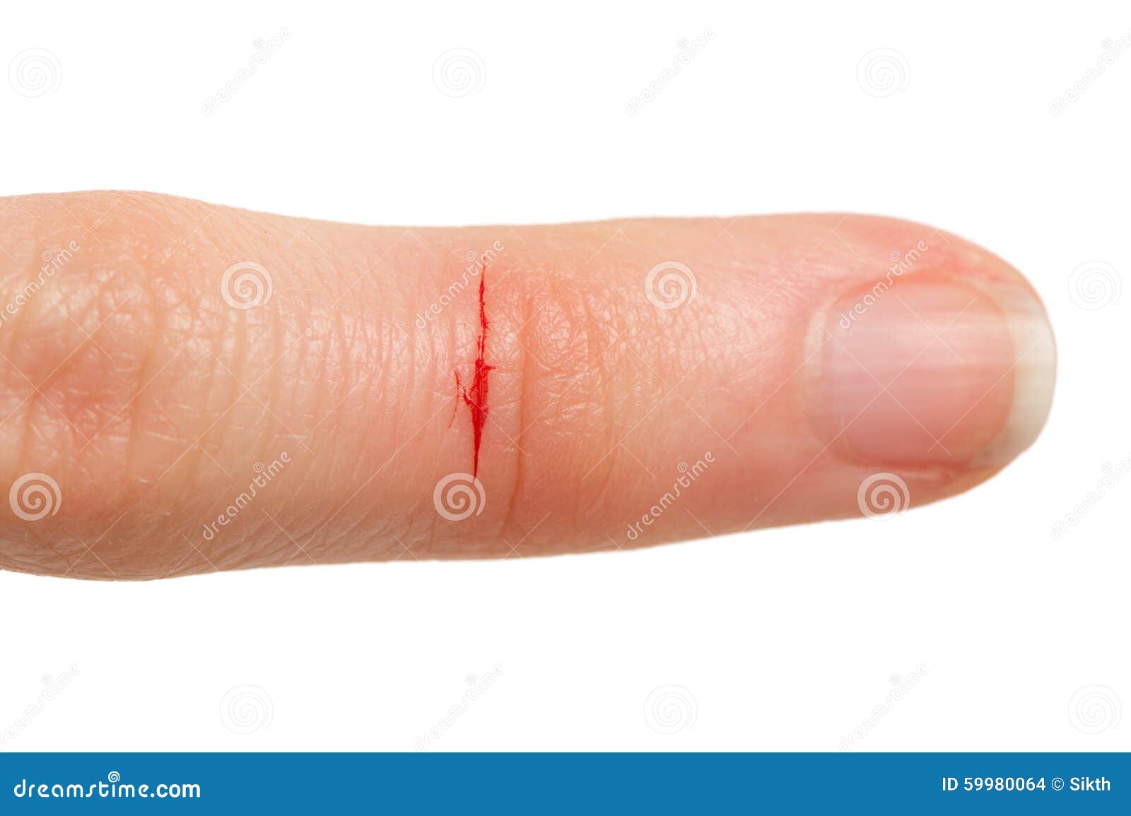 割破手指 库存照片. 图片 包括有 创伤, 红色, 的闪烁, 适应, 出血, 医疗, 剪切, 伤害, 手指 - 33809452