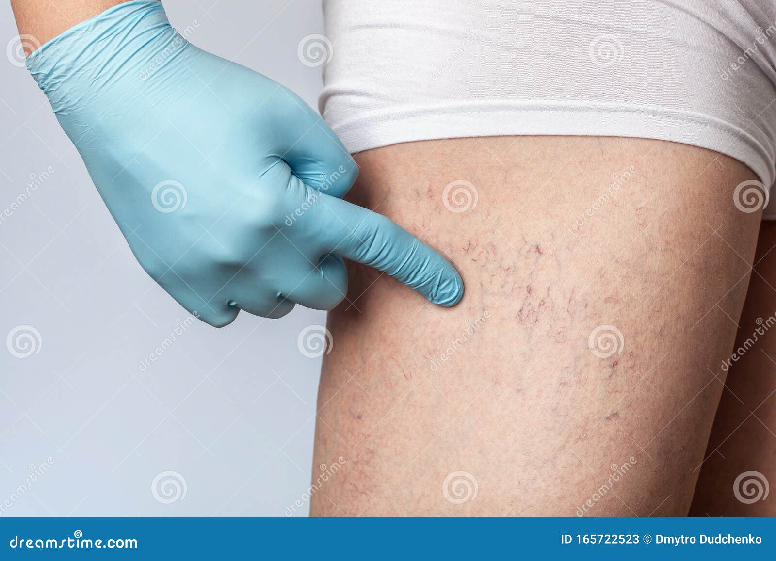 科学修复红血丝（六）皮肤微循环—修复红血丝皮肤受损敏感肌肤的主要、关键原则 - 知乎