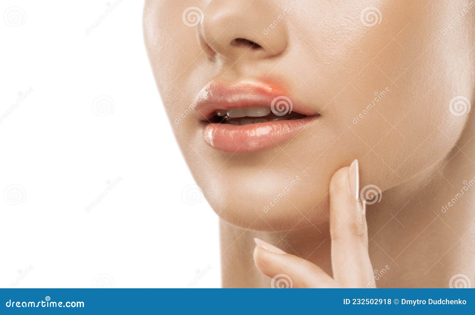 嘴唇上长痘（有图）是什么身体原因引起的？_百度知道