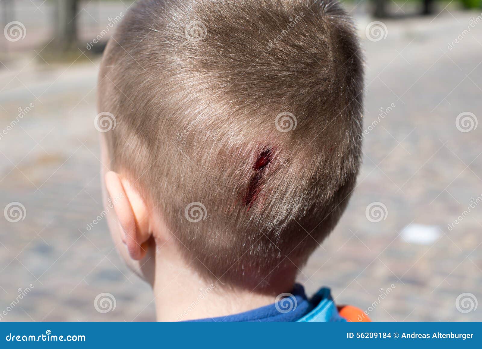 Young Male Patient with Serious Head Injury Against Gray Background ...