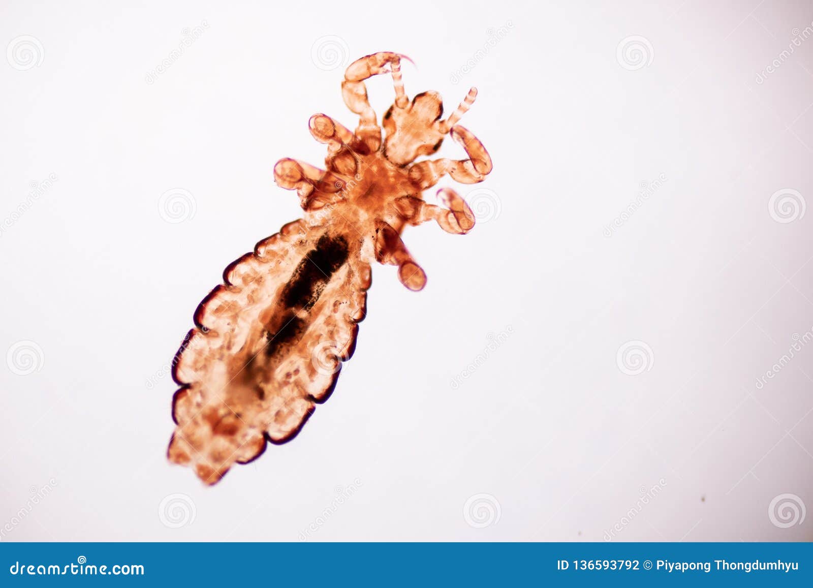 在头发和梳子的虱子 库存图片. 图片 包括有 跳蚤, 健康, 传染, 背包, 昆虫, 寄生生物, 疾病 - 154459311