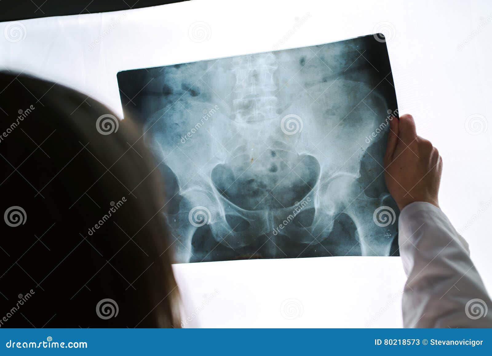 怎样读懂骨盆X线片 - 好医术早读文章 - 好医术-赋能医生守护生命