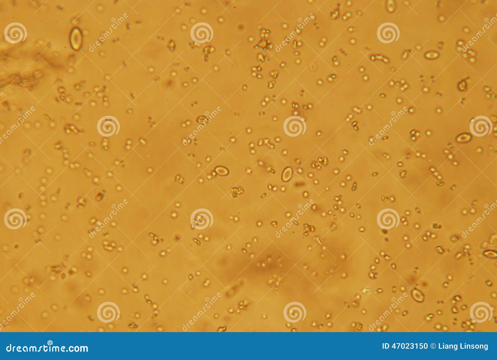 头虱-人虱属capitis，显微镜图片 库存照片. 图片 包括有 空白, 显微镜, 害虫, 昆虫, 母狗 - 70752104