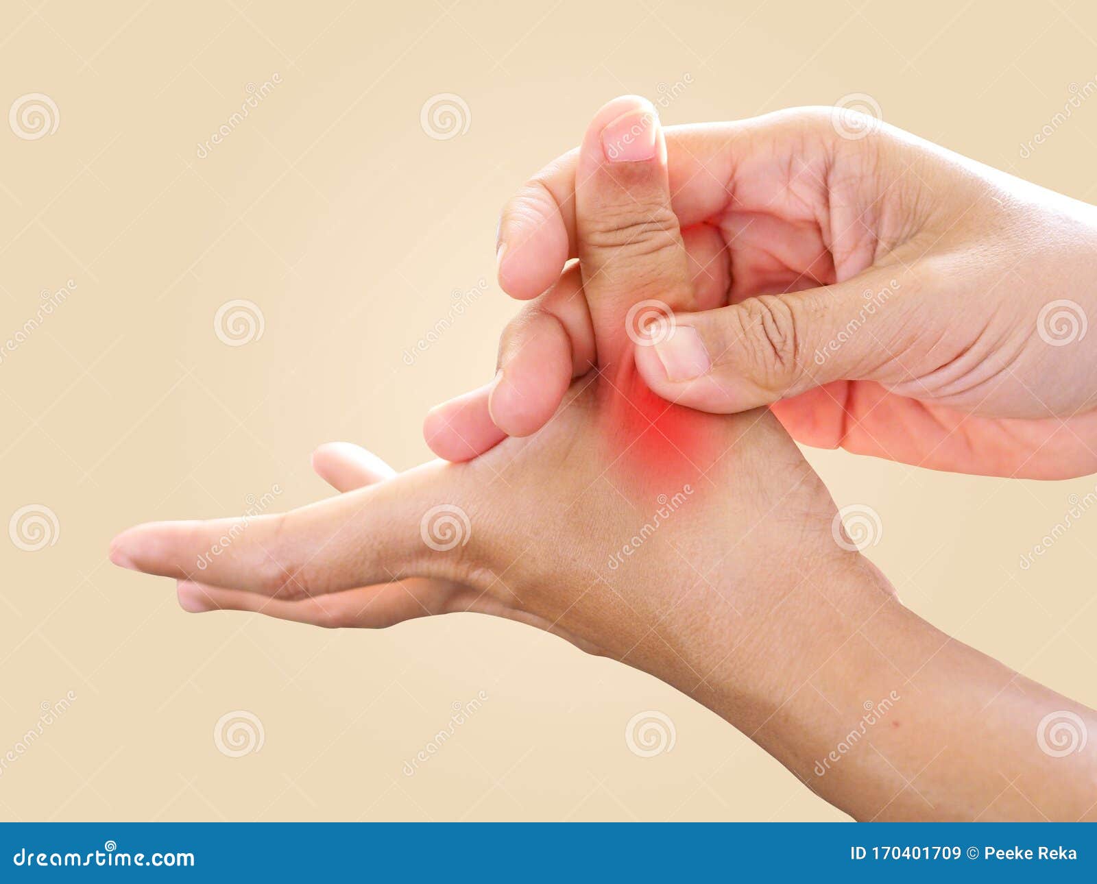 手痛、手指疼痛、工作引起的拇指指疼痛、神经发炎和触发指锁疾病 库存图片 图片 包括有 按摩, 腕骨 170401709