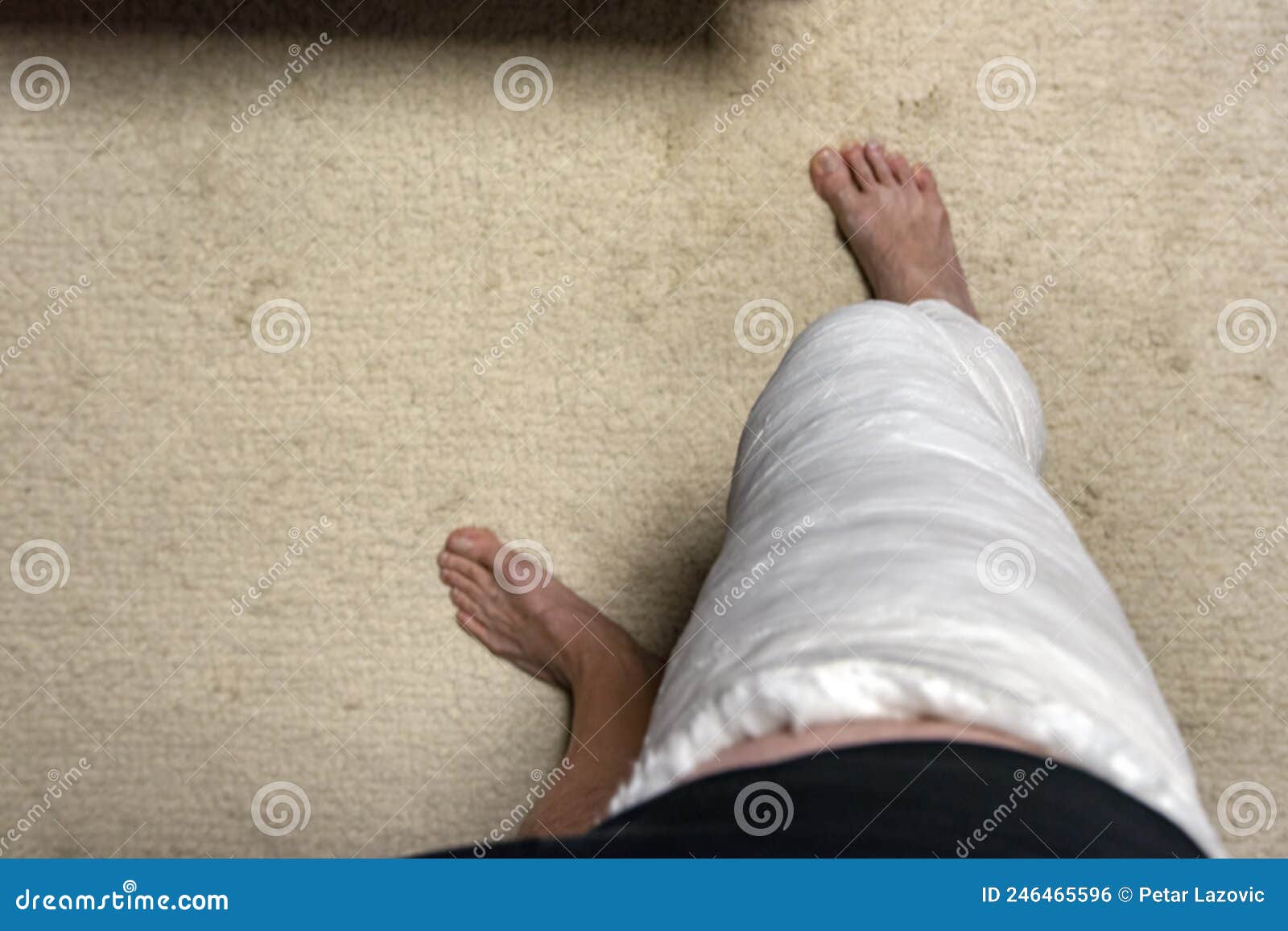 Man Broken Leg Using Crutches Walking Blue Carpet Stock Photo by ©AndreyPopov 180435692
