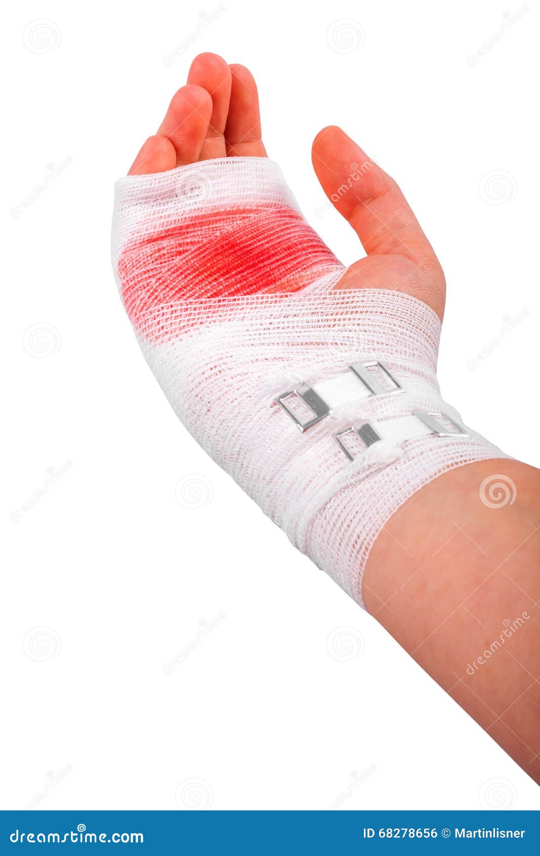 手腕受伤包扎真实图片,女生手腕割伤包扎图片 - 伤感说说吧