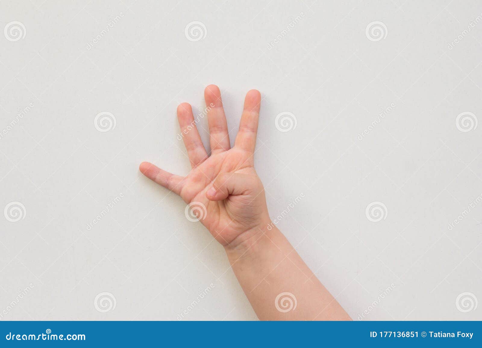 整形显微004：先天畸形---五岁小男孩双手“十二根手指头”