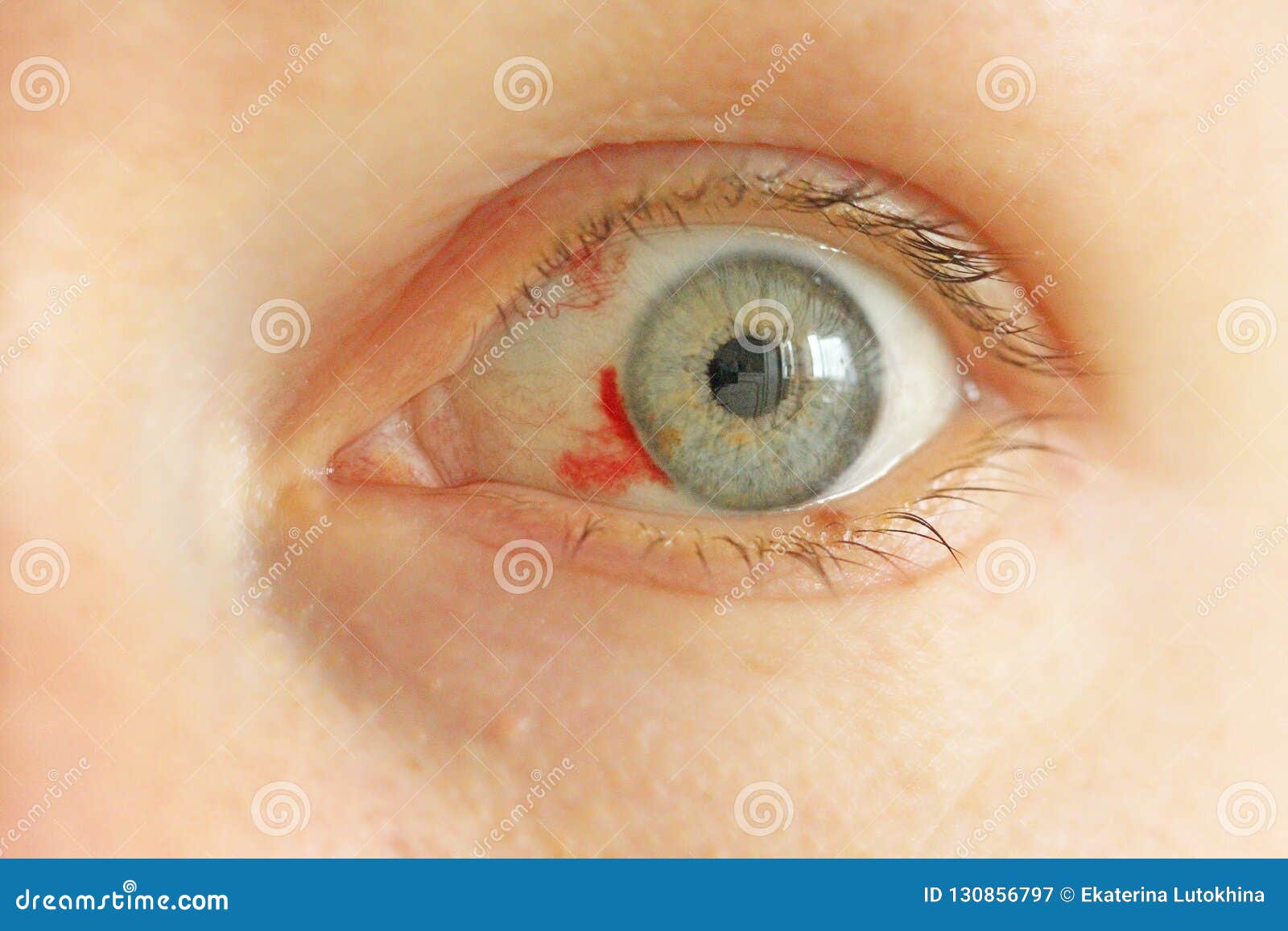 常见眼底疾病检查结果的秒懂解读_视网膜_彩照_天津
