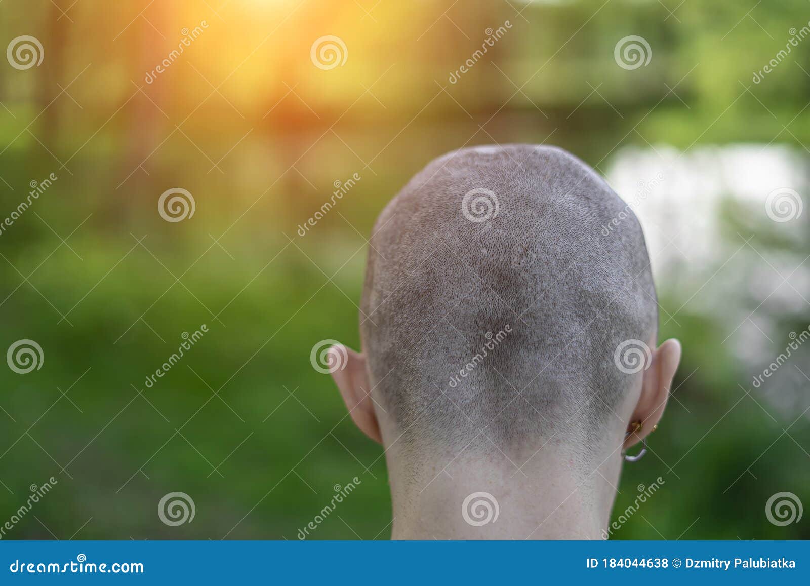 因癌症而接受化疗的秃顶女人正在掉头发照片摄影图片_ID:312462885-Veer图库