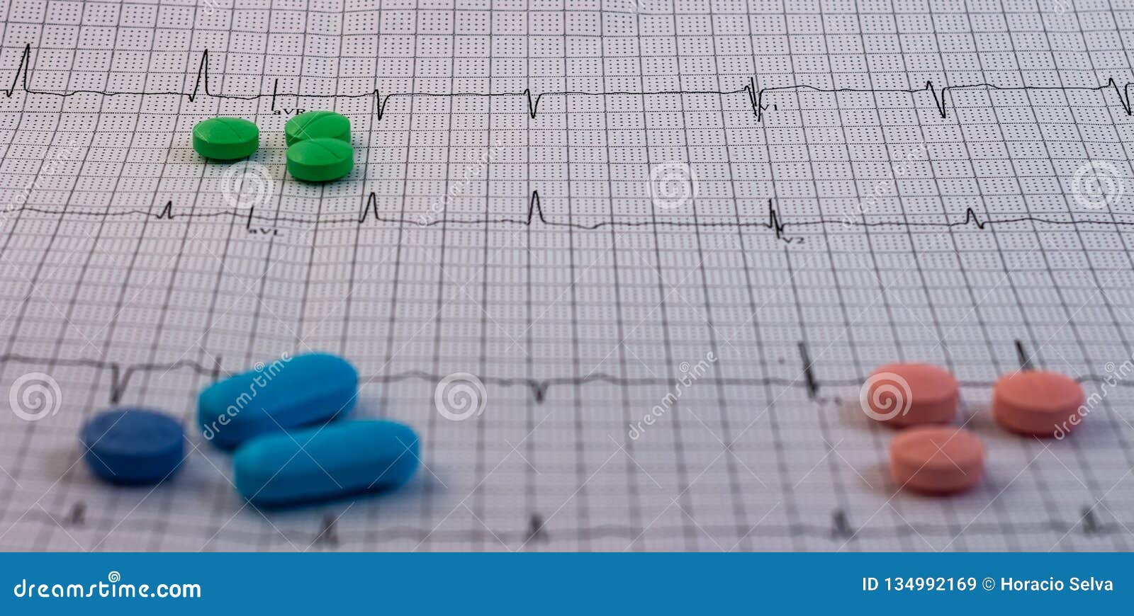 英国留学行前必备药品清单 你get到了吗?_IDP留学