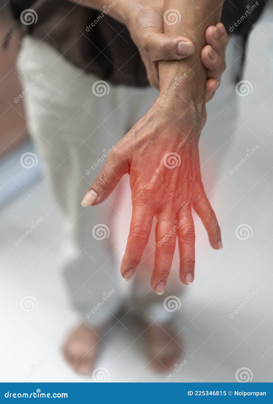 手麻痛指痛神经末梢刺痛. 这是格林的副作用 库存照片. 图片 包括有 梭子鱼, 创伤, 神经, 疾病, 影响 - 227333272