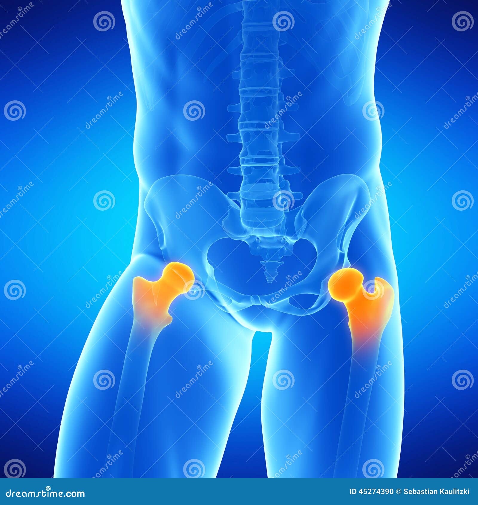 换股骨头商业保险给报吗 股骨头医保-全球五金网