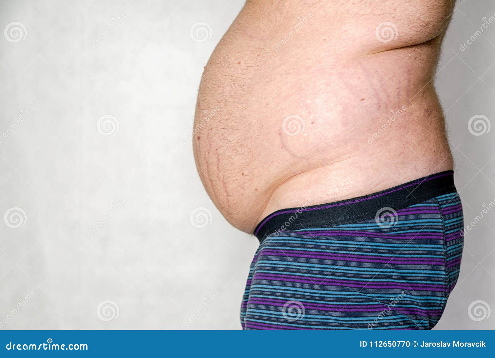 肥胖腹部 库存照片. 图片 包括有 肥胖病, 饮食, 特写镜头, 少量, 爱好健美者, 疾病, 超重, 男性 - 45956442