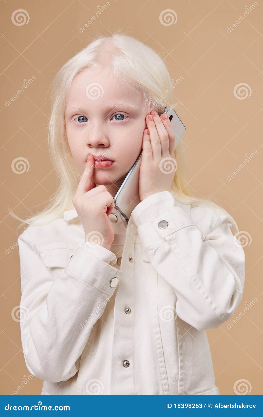 11岁白化病女孩视力仅0.04，同学争当她的“眼睛”_澎湃号·湃客_澎湃新闻-The Paper